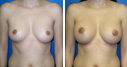 Before & After Photos